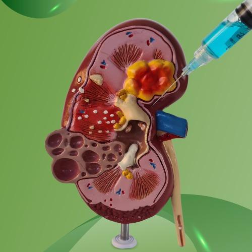 Nephrological Disorder